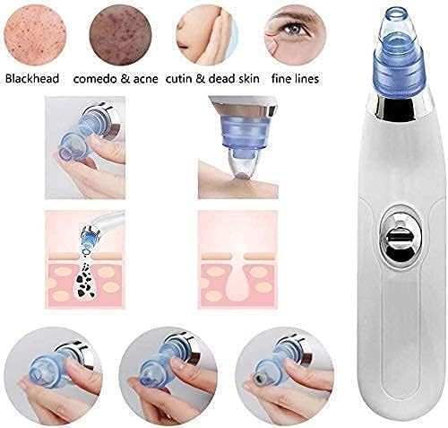 4-in-1 Electric Blackhead Remover – Pore Vacuum Cleaner & Acne Suction Tool