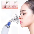 4-in-1 Electric Blackhead Remover – Pore Vacuum Cleaner & Acne Suction Tool