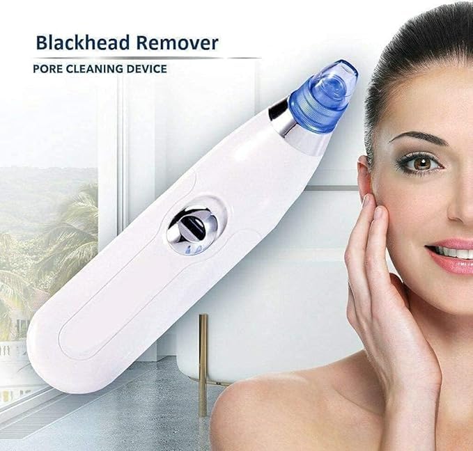 4-in-1 Electric Blackhead Remover – Pore Vacuum Cleaner & Acne Suction Tool