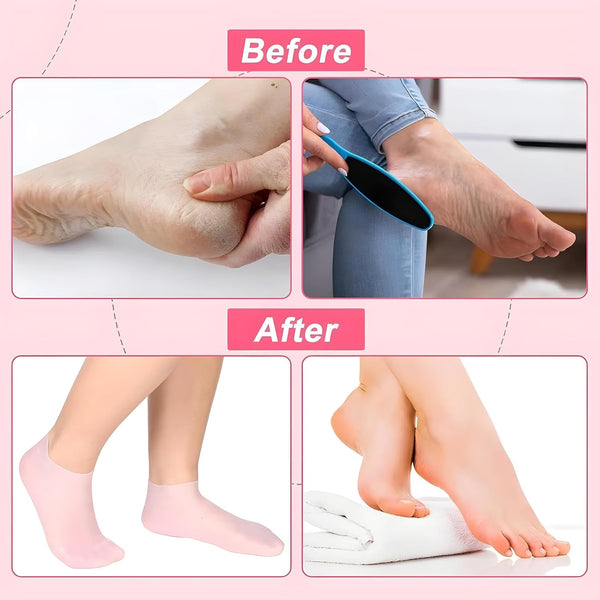 Silicone Moisturizing Foot Socks – Reusable Gel Heel Socks for Dry & Rough Feet Care