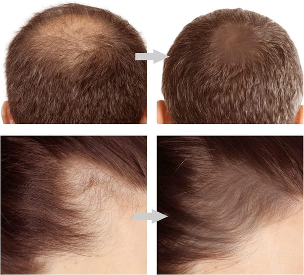Hairline Shadow Powder Stick – Instant Hair Root Touch-Up & Hairline Filling Powder for Women & Men